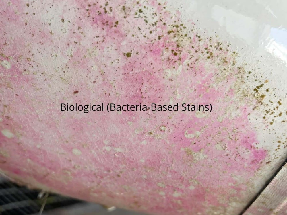 Bacterial stain Photo
