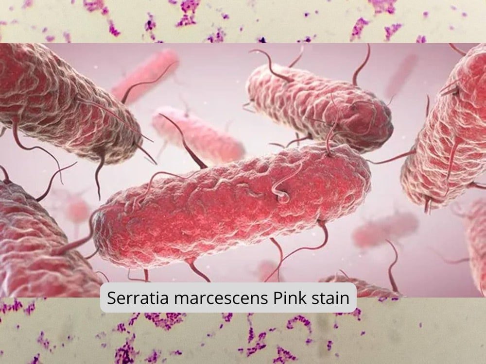 Enlarged Under a microscope Serratia marcescens Pink stain